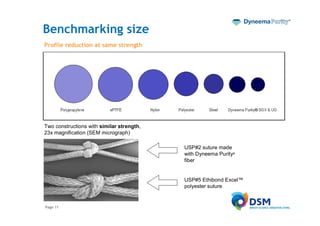 Benchmarking size
Profile reduction at same strength




Two constructions with similar strength,
23x magnification (SEM micrograph)

                                           USP#2 suture made
                                           with Dyneema Purity®
                                           fiber


                                           USP#5 Ethibond Excel™
                                           polyester suture


Page 11
 