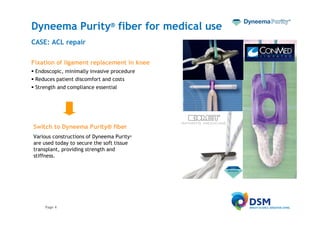 Dyneema Purity® fiber for medical use
CASE: ACL repair

Fixation of ligament replacement in knee
 Endoscopic, minimally invasive procedure
 Reduces patient discomfort and costs
 Strength and compliance essential




Switch to Dyneema Purity® fiber
Various constructions of Dyneema Purity®
are used today to secure the soft tissue
transplant, providing strength and
stiffness.




     Page 4
 