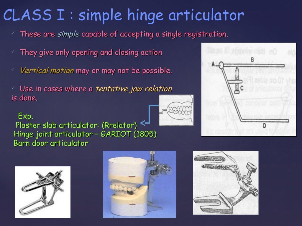 Summary of articulators in prosthodontics