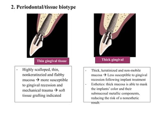 CBCT in Implants- Summary