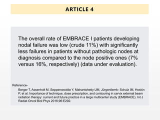 The overall rate of EMBRACE I patients developing
nodal failure was low (crude 11%) with significantly
less failures in patients without pathologic nodes at
diagnosis compared to the node positive ones (7%
versus 16%, respectively) (data under evaluation).
Reference-
Berger T, Assenholt M, Seppenwoolde Y, Mahantshetty UM, Jürgenliemk- Schulz IM, Hoskin
P, et al. Importance of technique, dose prescription, and contouring in cervix external beam
radiation therapy: current and future practice in a large multicenter study (EMBRACE). Int J
Radiat Oncol Biol Phys 2016;96:E292.
ARTICLE 4
 