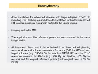 • dose escalation for advanced disease with large adaptive CTV-T HR
including IC/IS techniques and dose de-escalation for limited size CTV-T
HR to spare organs at risk and in particular the upper vagina.
• imaging method is MRI
• The applicator and the reference points are reconstructed in the same
image series.
• All treatment plans have to be optimized to achieve defined planning
aims for dose and volume parameters for tumor (D98 for GTVres) and
target volumes (e.g. D90-95 Gy for adaptive CTV-T HR) and for 2cm3
reference volumes for OARs (e.g. <80 Gy for bladder, <65 Gy for
rectum) and for vaginal reference points (recto-vaginal point < 65 Gy,
PIBS).
Brachytherapy
 