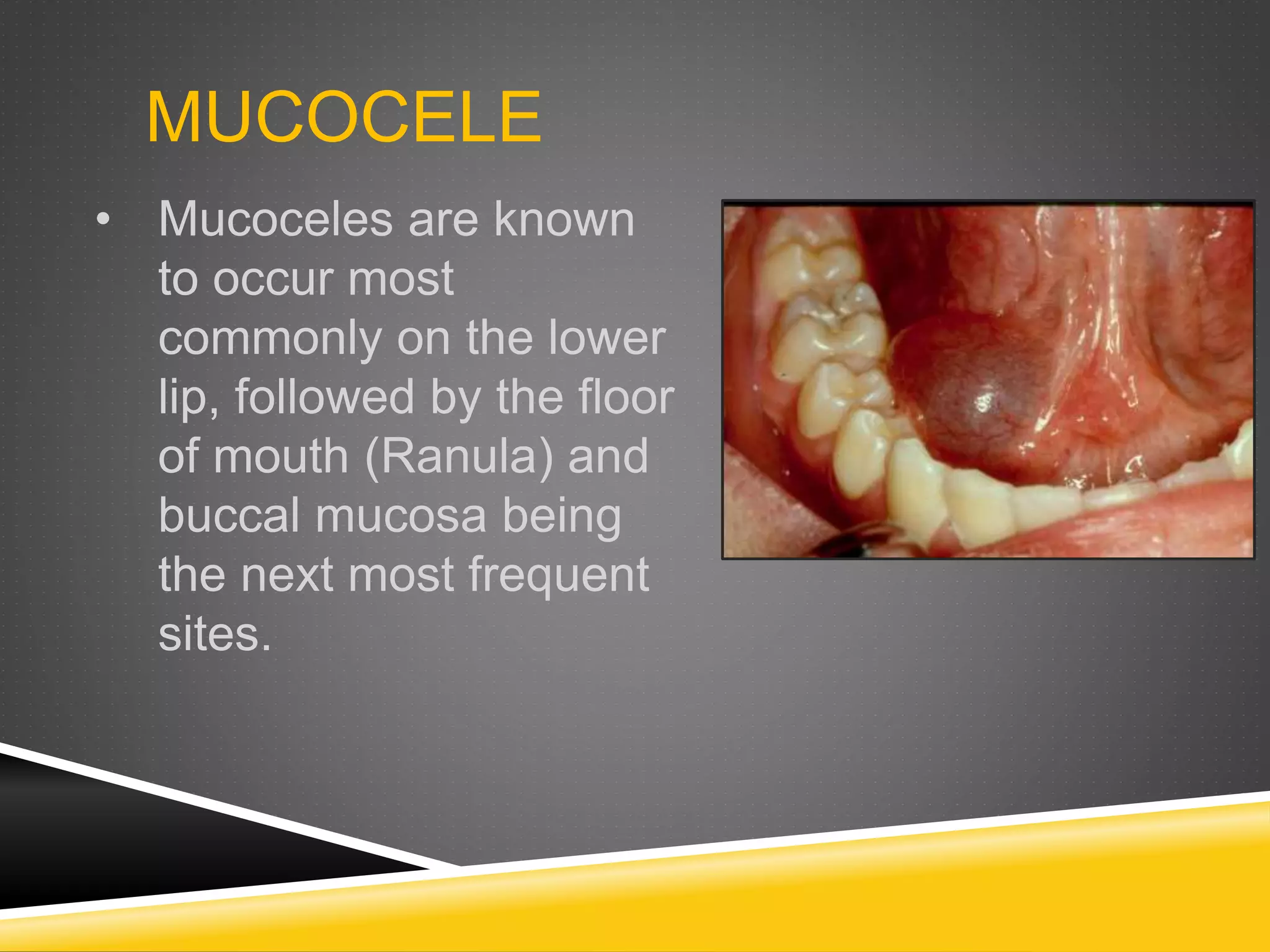 Summary (pediatric oral pathology) | PPTX