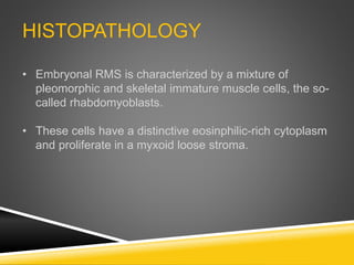 Embryonal Rms Summary (pediatric oral pathology) | PPTX