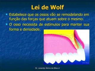 Lei de Wolf Estabelece que os ossos vão se remodelando em função das forças que atuam sobre o mesmo. O osso necessita de estímulos para manter sua forma e densidade.   