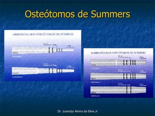 Osteótomos de Summers 