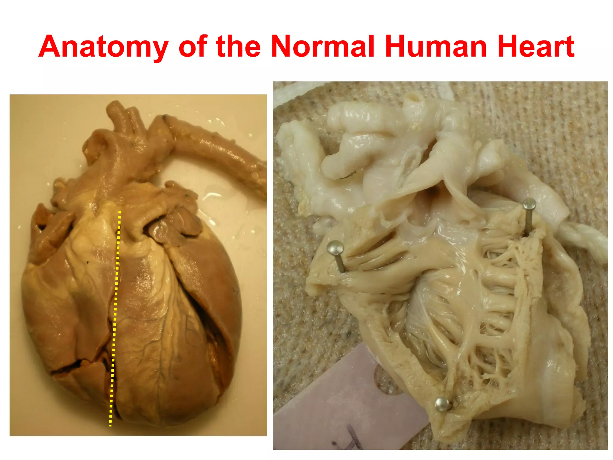 Anatomy of the Normal Human Heart
 