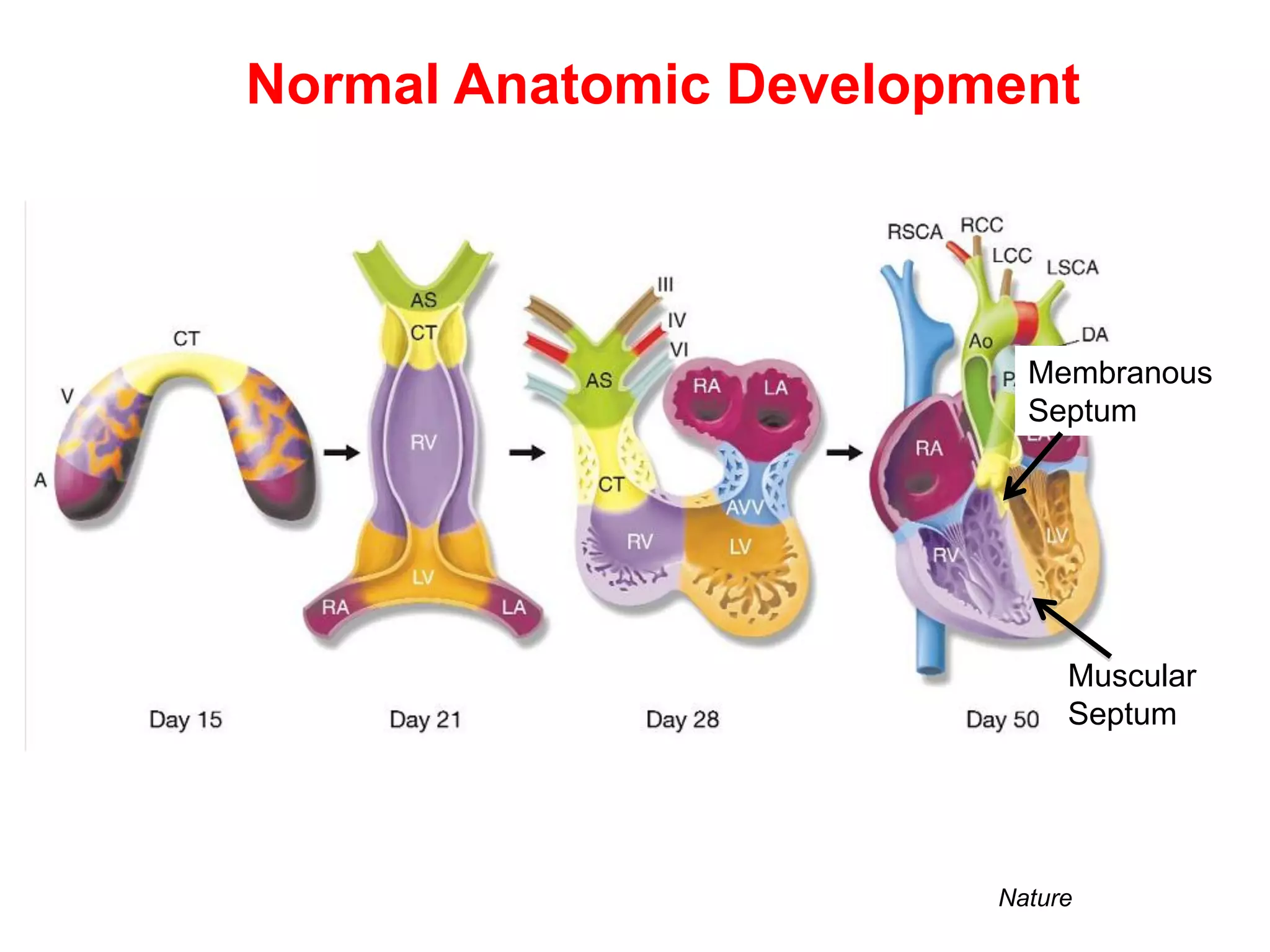Normal Anatomic Development



                          Membranous
                          Septum




                             Muscular
                             Septum




                        Nature
 