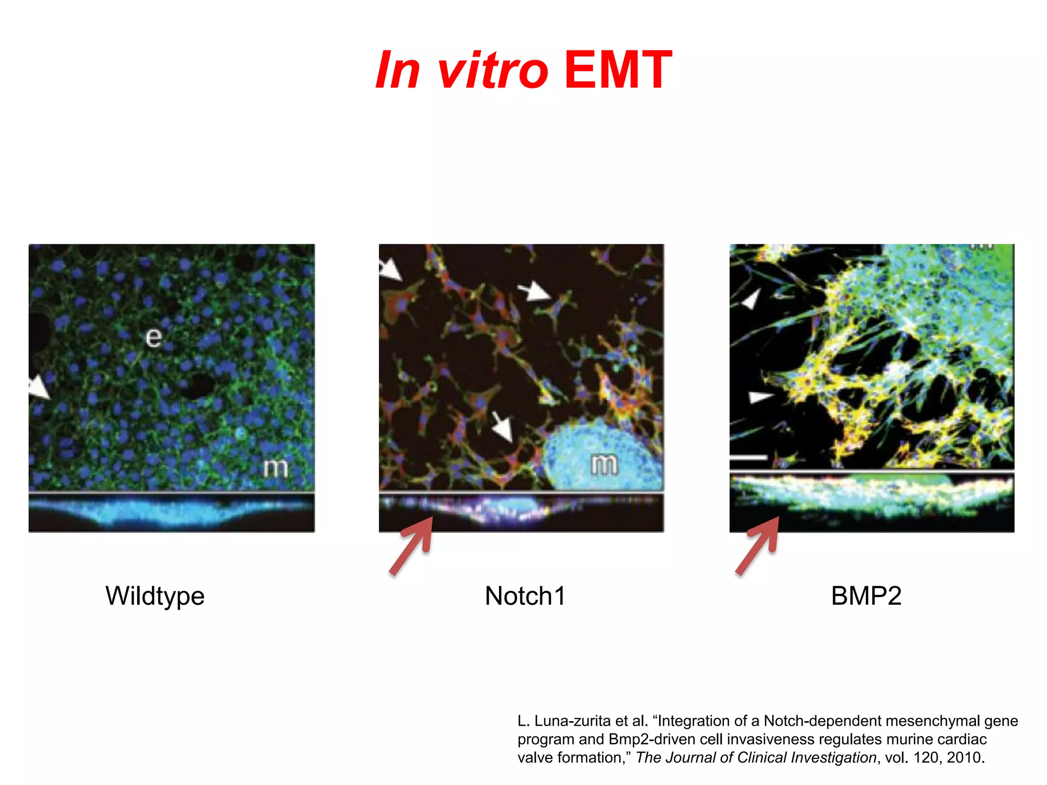 In vitro EMT




Wildtype       Notch1                                         BMP2



                 L. Luna-zurita et al. “Integration of a Notch-dependent mesenchymal gene
                 program and Bmp2-driven cell invasiveness regulates murine cardiac
                 valve formation,” The Journal of Clinical Investigation, vol. 120, 2010.
 