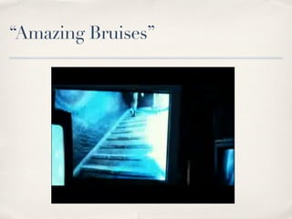“Amazing Bruises”
 