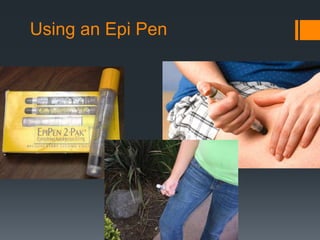 Using an Epi Pen
 