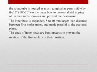 the roundtube is housed as much gingival as permissible by
the15° (10°-20°) to the inner bow to prevent distal tipping
of the first molar crowns and prevent their extrusion
The inner bow is expanded, 8 to 10 mm larger than distance
between first molar tubes, and made parallel to the occlusal
plane.
The ends of inner bows are bent inwards to prevent the
rotation of the first molars in their position.
 