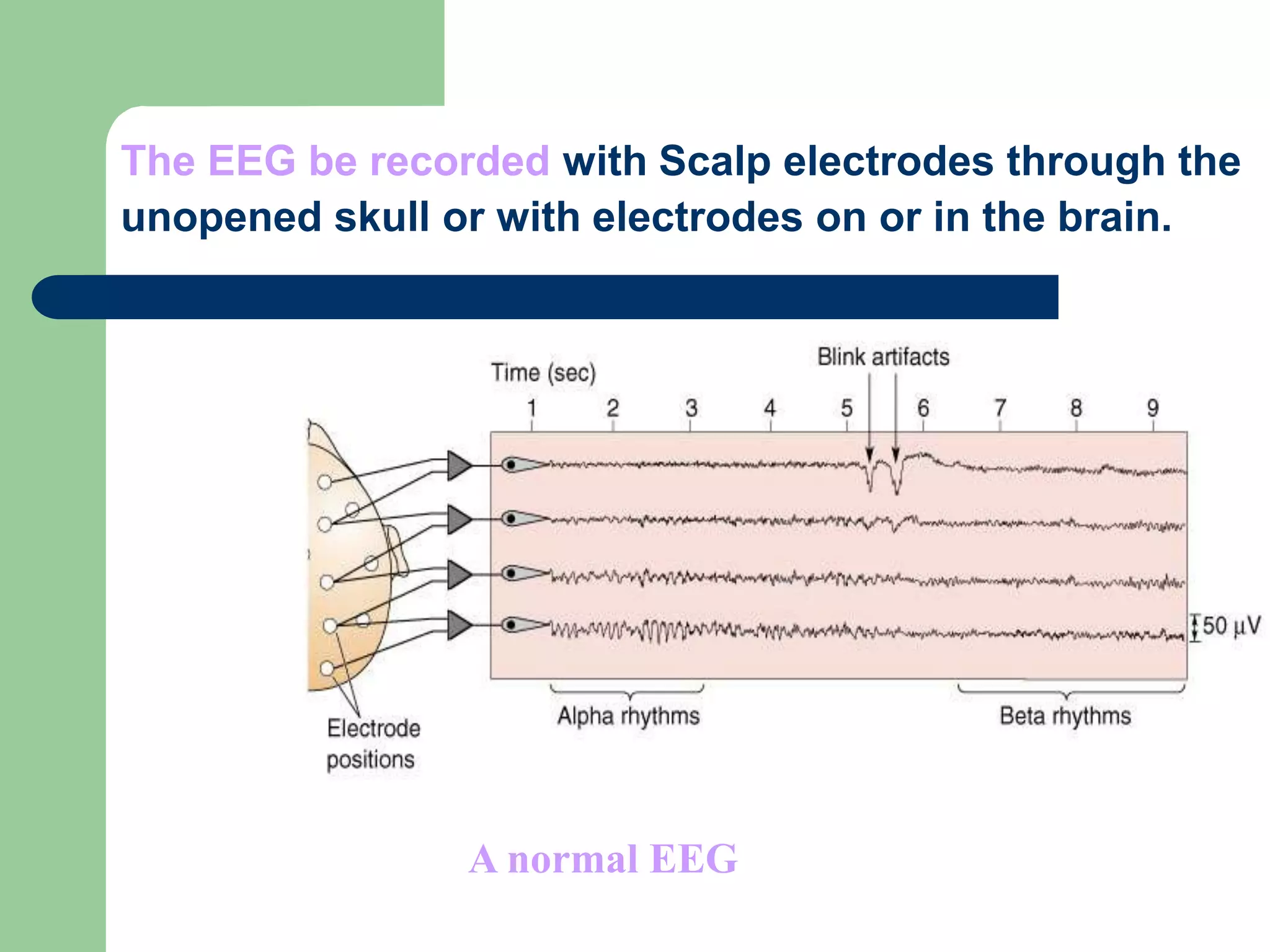 The EEG be recorded with Scalp electrodes through the
unopened skull or with electrodes on or in the brain.
A normal EEG
 