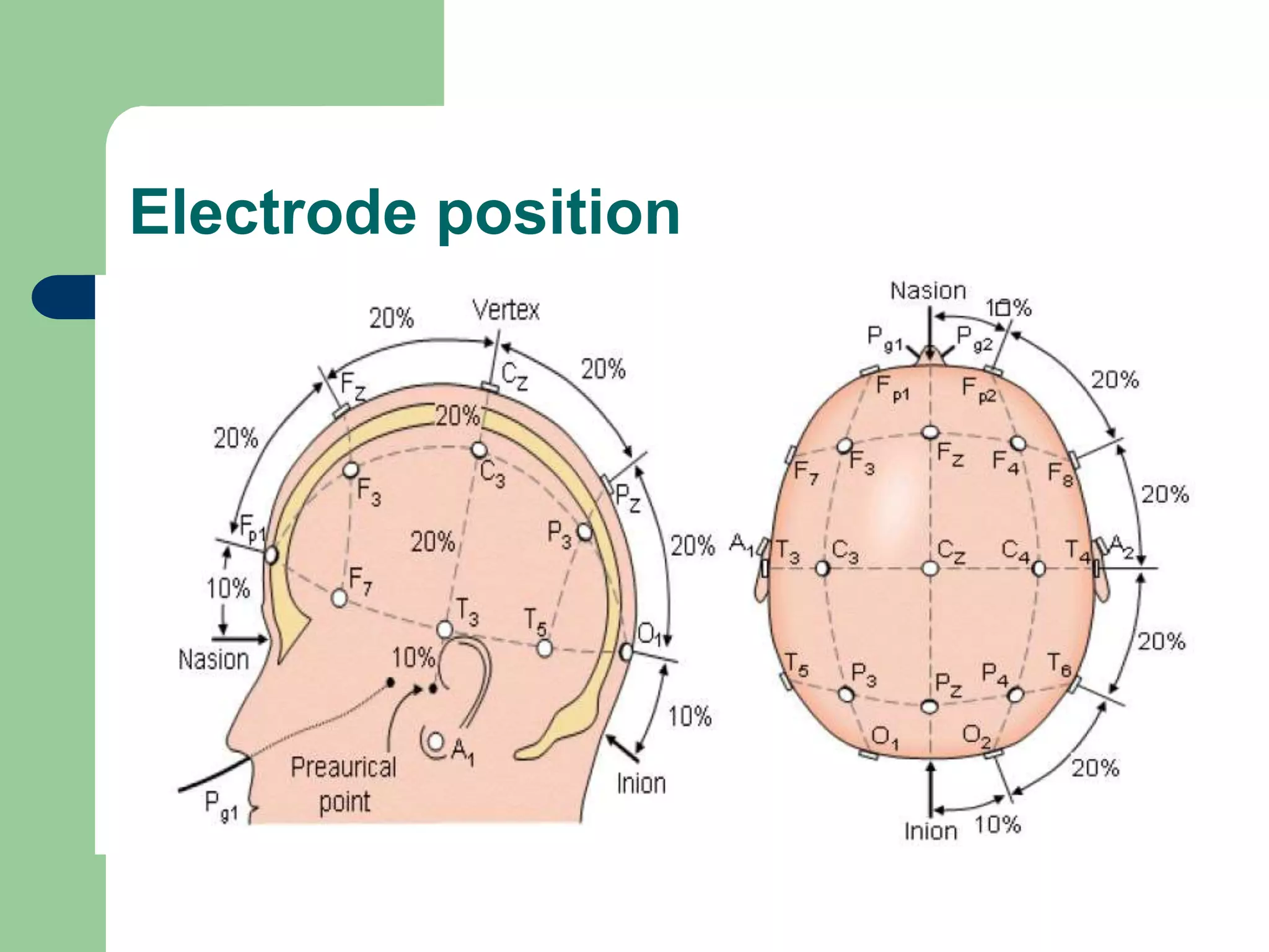 Electrode position
 