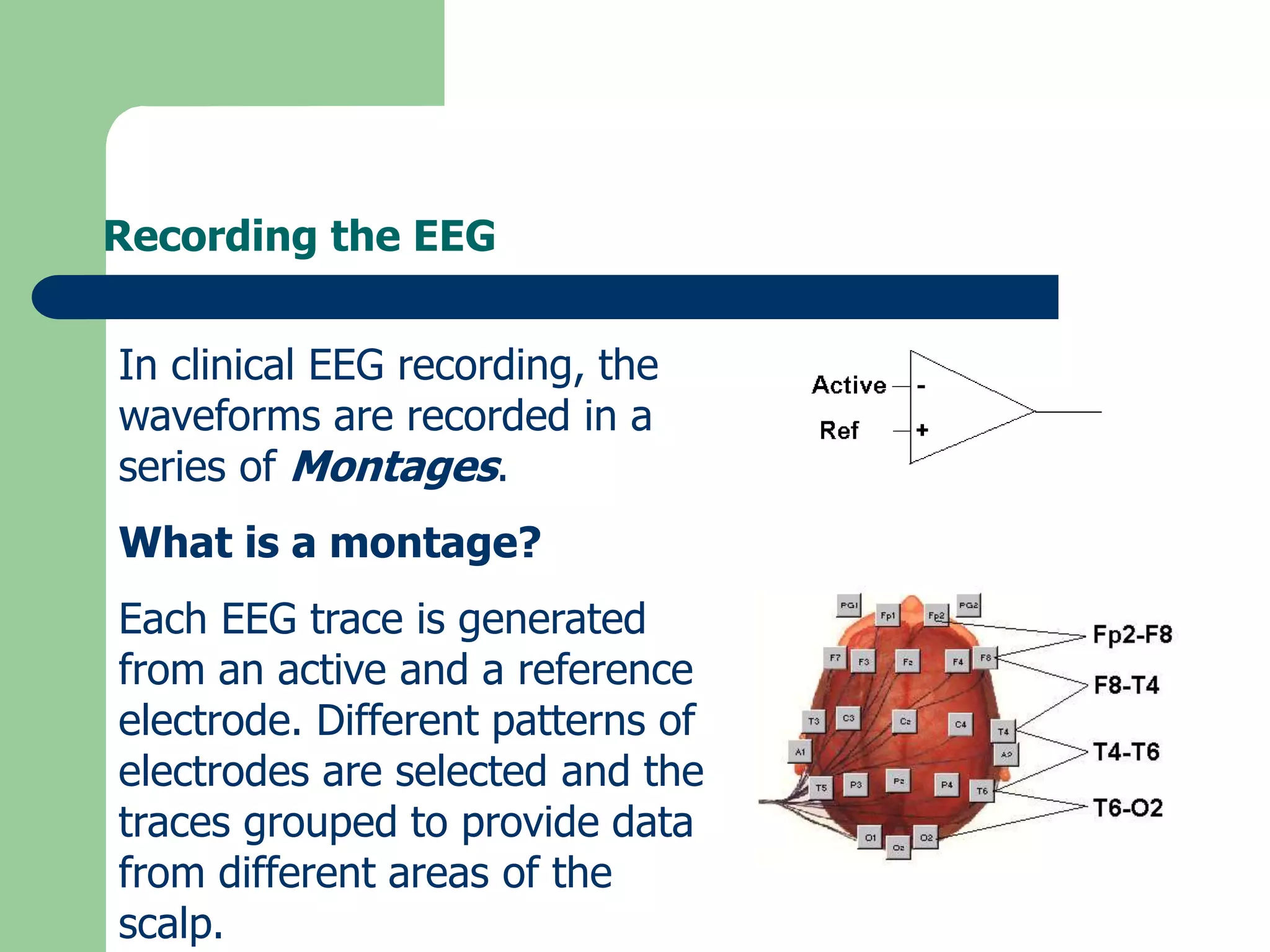 Recording the EEG
In clinical EEG recording, the
waveforms are recorded in a
series of Montages.
What is a montage?
Each EEG trace is generated
from an active and a reference
electrode. Different patterns of
electrodes are selected and the
traces grouped to provide data
from different areas of the
scalp.
 