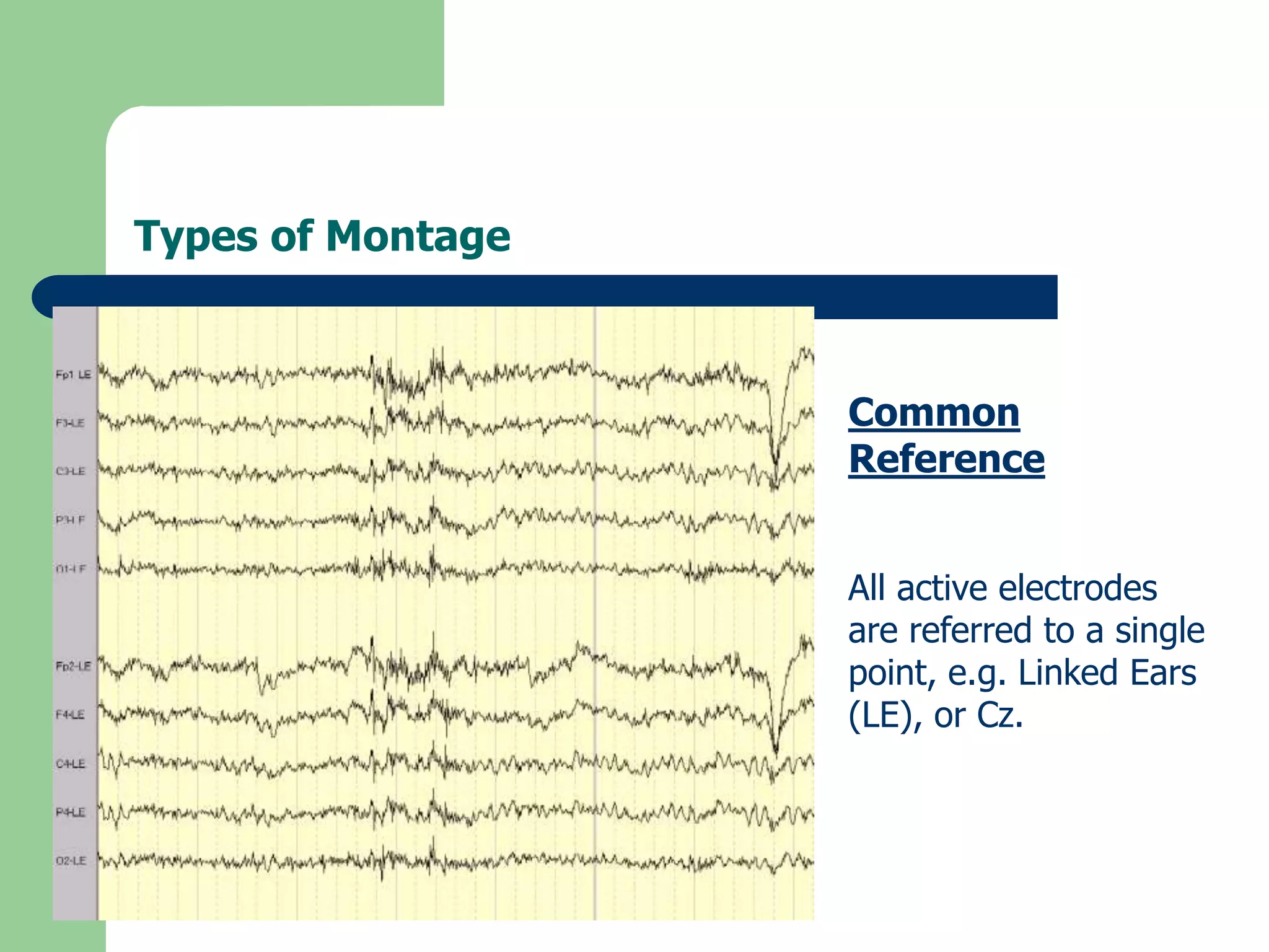 Types of Montage
Common
Reference
All active electrodes
are referred to a single
point, e.g. Linked Ears
(LE), or Cz.
 
