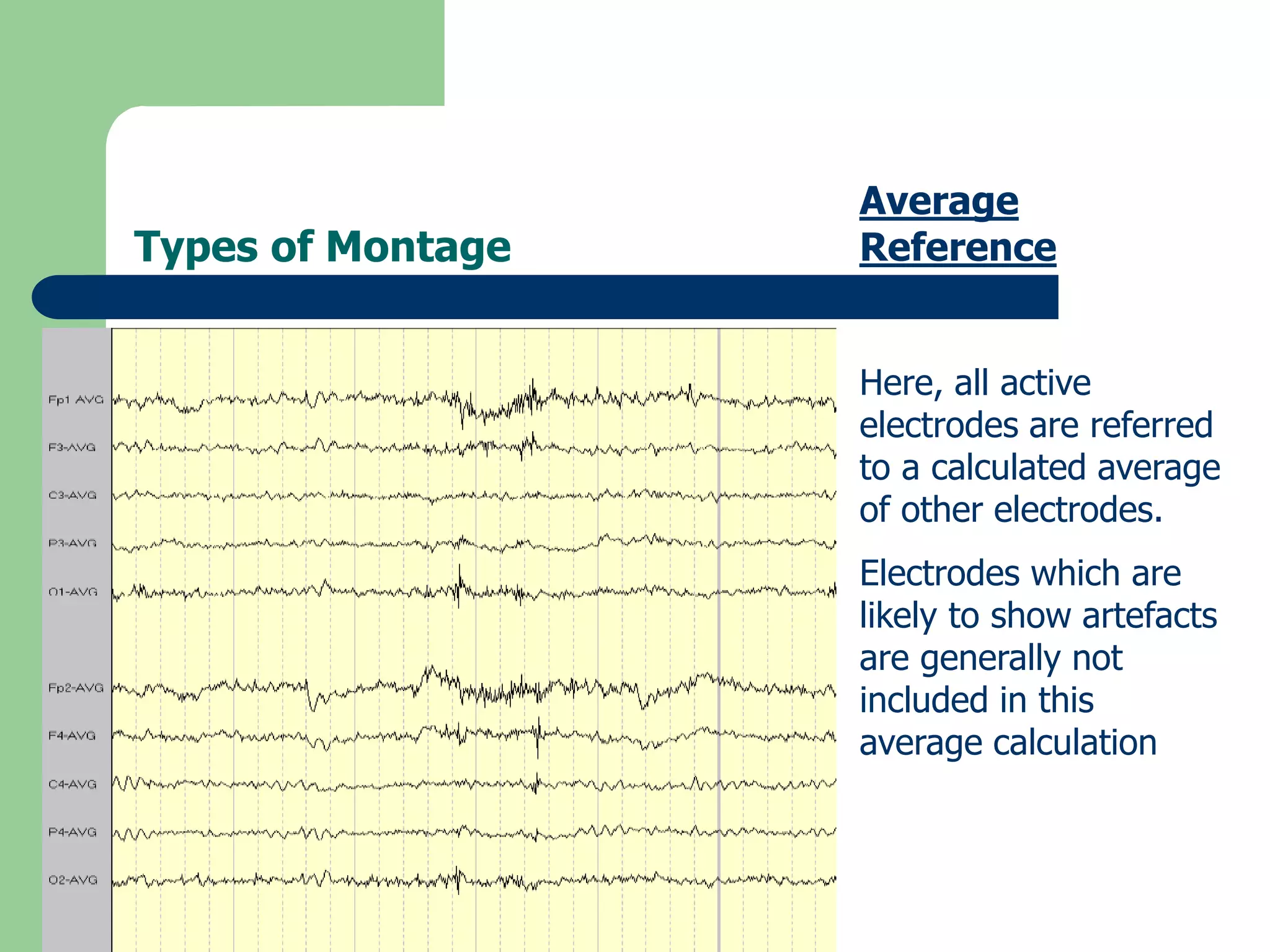 Types of Montage
Average
Reference
Here, all active
electrodes are referred
to a calculated average
of other electrodes.
Electrodes which are
likely to show artefacts
are generally not
included in this
average calculation
 