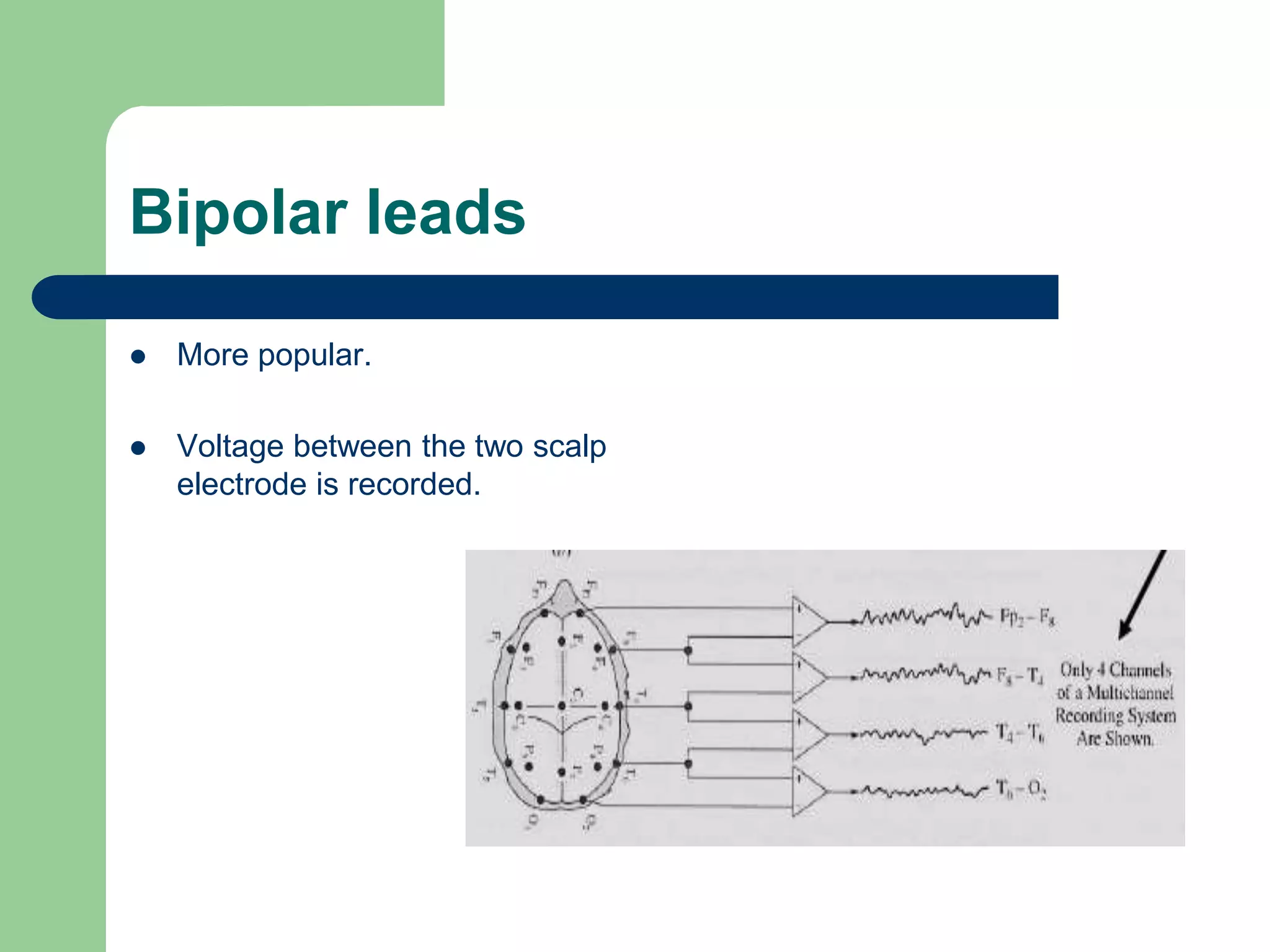 Bipolar leads
 More popular.
 Voltage between the two scalp
electrode is recorded.
 