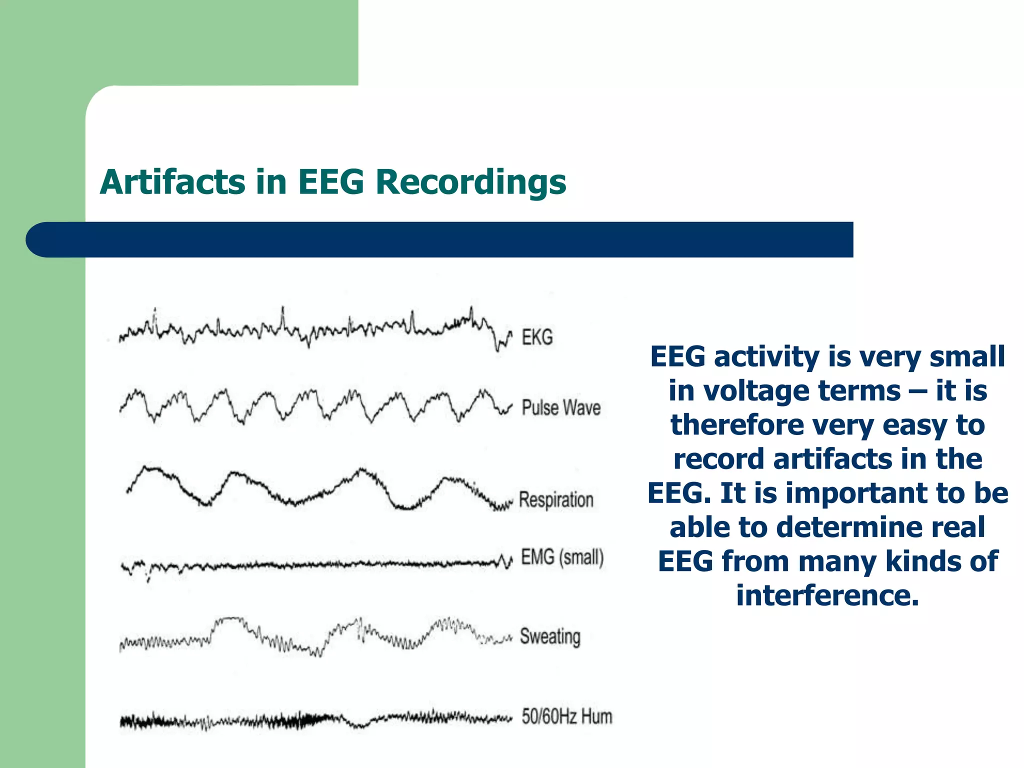 Artifacts in EEG Recordings
EEG activity is very small
in voltage terms – it is
therefore very easy to
record artifacts in the
EEG. It is important to be
able to determine real
EEG from many kinds of
interference.
 