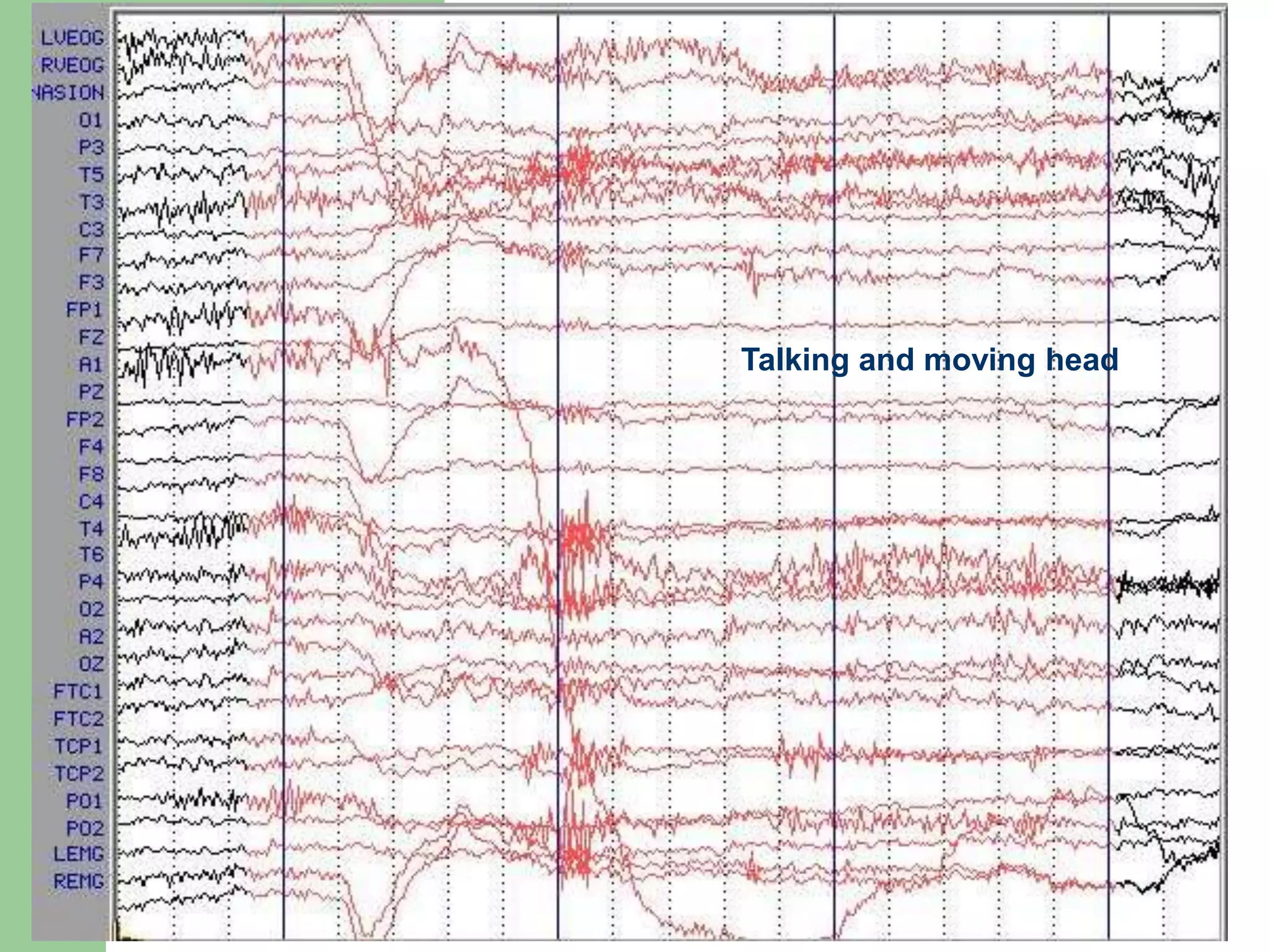 Talking and moving head
 
