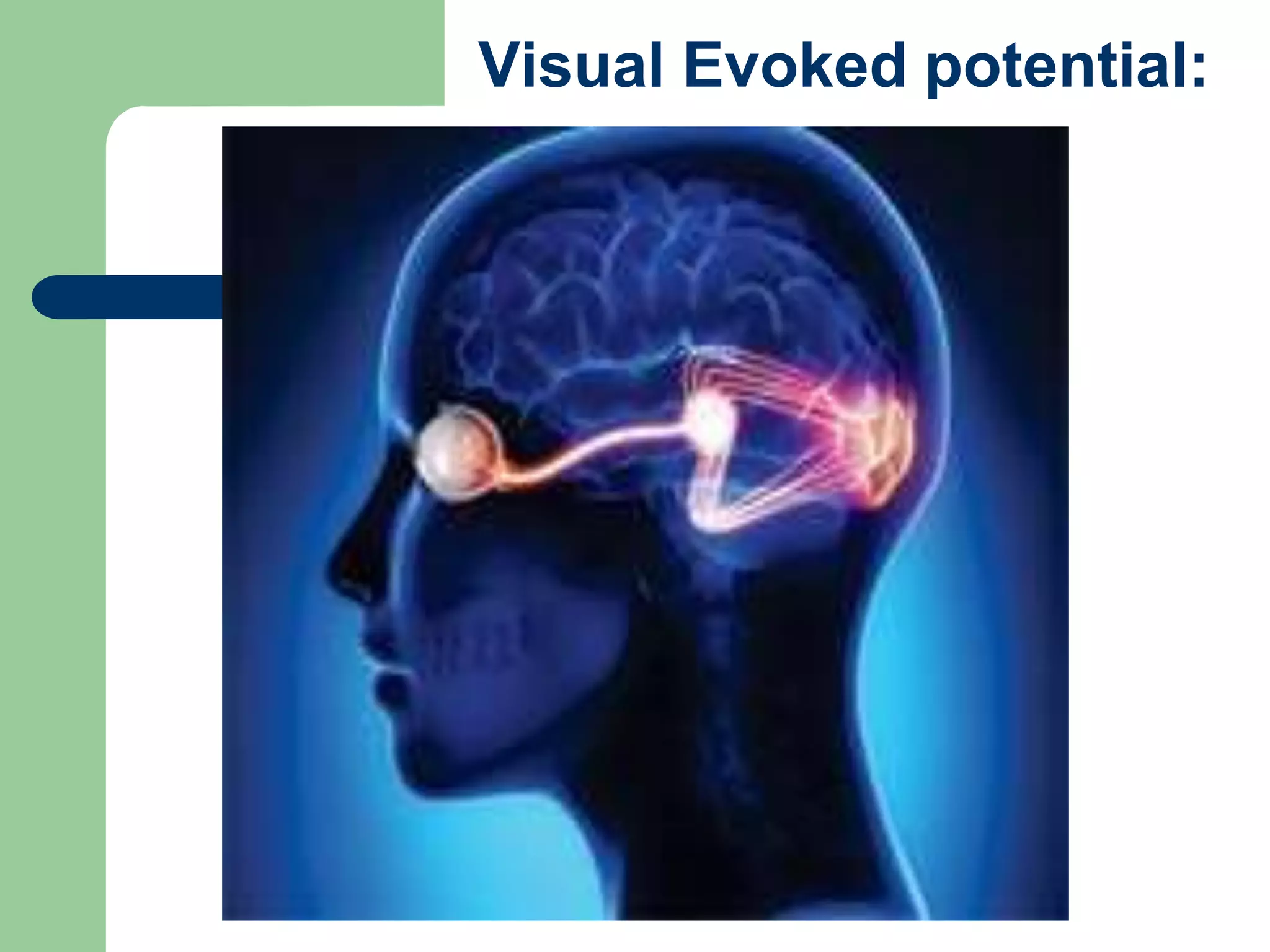 Visual Evoked potential:
 