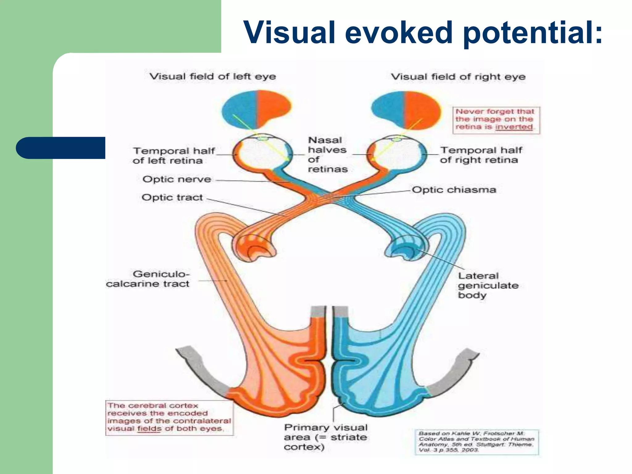 Visual evoked potential:
 