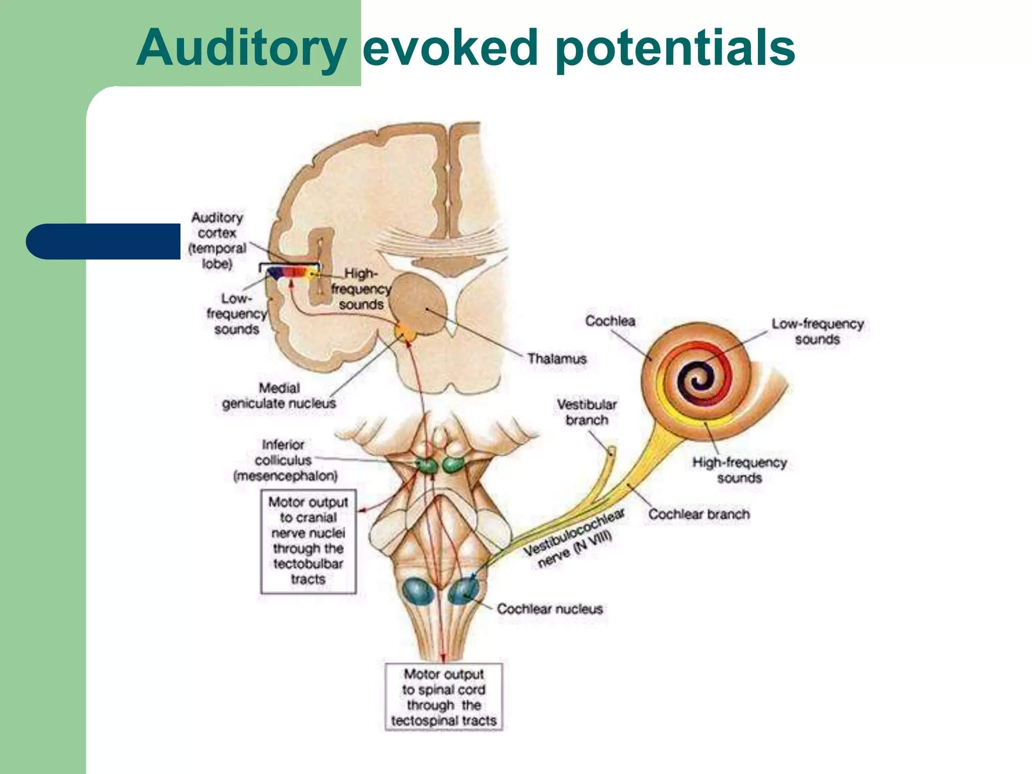Auditory evoked potentials
 