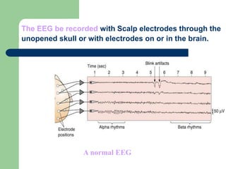 The EEG be recorded with Scalp electrodes through the
unopened skull or with electrodes on or in the brain.
A normal EEG
 