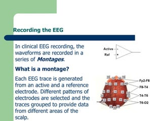 Recording the EEG
In clinical EEG recording, the
waveforms are recorded in a
series of Montages.
What is a montage?
Each EEG trace is generated
from an active and a reference
electrode. Different patterns of
electrodes are selected and the
traces grouped to provide data
from different areas of the
scalp.
 