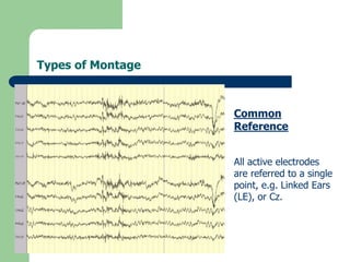 Types of Montage
Common
Reference
All active electrodes
are referred to a single
point, e.g. Linked Ears
(LE), or Cz.
 