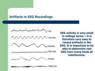 Artifacts in EEG Recordings
EEG activity is very small
in voltage terms – it is
therefore very easy to
record artifacts in the
EEG. It is important to be
able to determine real
EEG from many kinds of
interference.
 