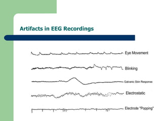 Artifacts in EEG Recordings
 