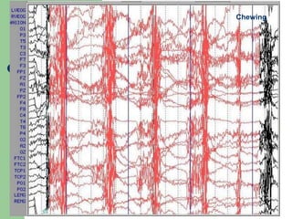 Chewing
 