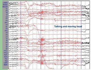 Talking and moving head
 