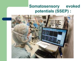 Somatosensory evoked
potentials (SSEP) :
 