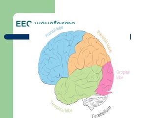 EEG waveforms
 