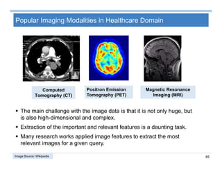 85
Popular Imaging Modalities in Healthcare Domain
Computed
Tomography (CT)
 The main challenge with the image data is that it is not only huge, but
is also high-dimensional and complex.
 Extraction of the important and relevant features is a daunting task.
 Many research works applied image features to extract the most
relevant images for a given query.
Positron Emission
Tomography (PET)
Magnetic Resonance
Imaging (MRI)
Image Source: Wikipedia
 
