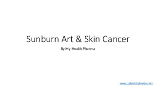 Sunburn Art & Skin Cancer
By My Health Pharma
www.myhealthpharma.com
 