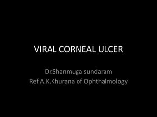 VIRAL CORNEAL ULCER
Dr.Shanmuga sundaram
Ref.A.K.Khurana of Ophthalmology
 