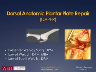 Dorsal Anatomic Plantar Plate Repair (DAPPR) ,[object Object]