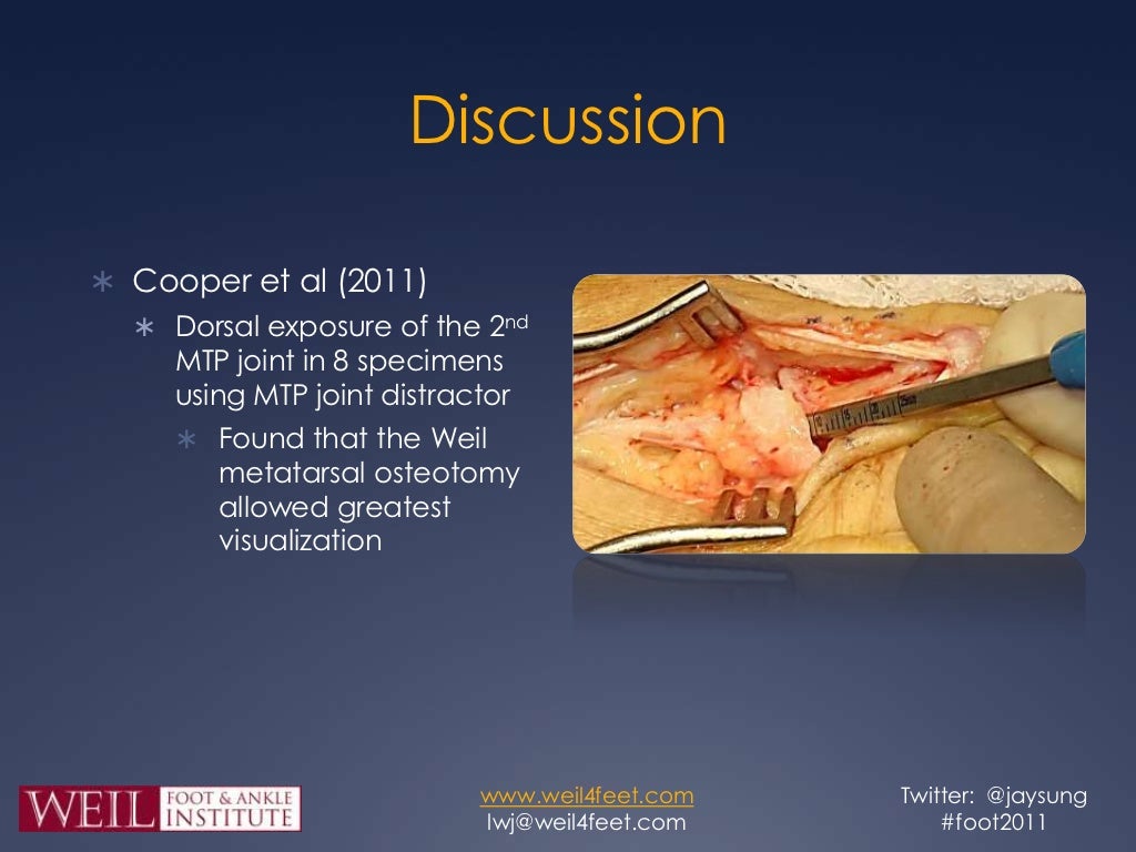 Dorsal Anatomic Plantar Plate Repair Dorsal Anatomic Plantar Plate Repair