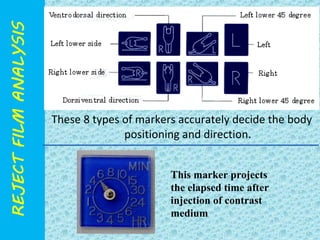 These 8 types of markers accurately decide the body 
positioning and direction. 
This marker projects 
the elapsed time after 
injection of contrast 
medium 
 