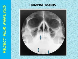 CRIMPING MARKS 
 
