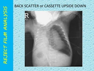 BACK SCATTER or CASSETTE UPSIDE DOWN 
 