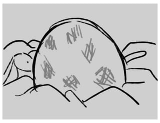 Sunnyside Up - Act 1