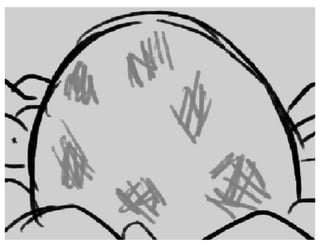 Sunnyside Up - Act 1