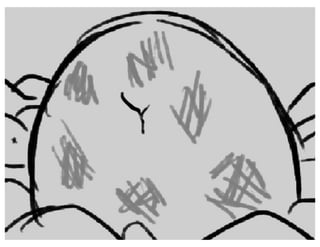 Sunnyside Up - Act 1