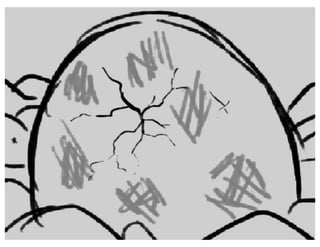 Sunnyside Up - Act 1