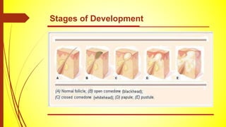 Stages of Development
 