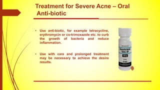 • Use anti-biotic, for example tetracycline,
erythromycin or co-trimoxazole etc. to curb
the growth of bacteria and reduce
inflammation.
• Use with care and prolonged treatment
may be necessary to achieve the desire
results.
Treatment for Severe Acne – Oral
Anti-biotic
 
